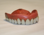 Vulcanised rubber dentures, early 1900s